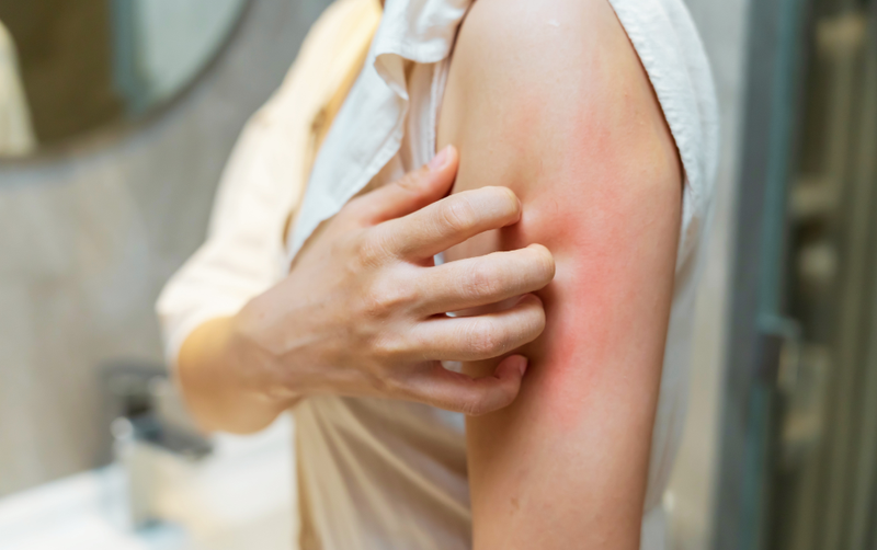 Skin allergy: what is it, how do you recognize it, and how do you choose products that are safe?