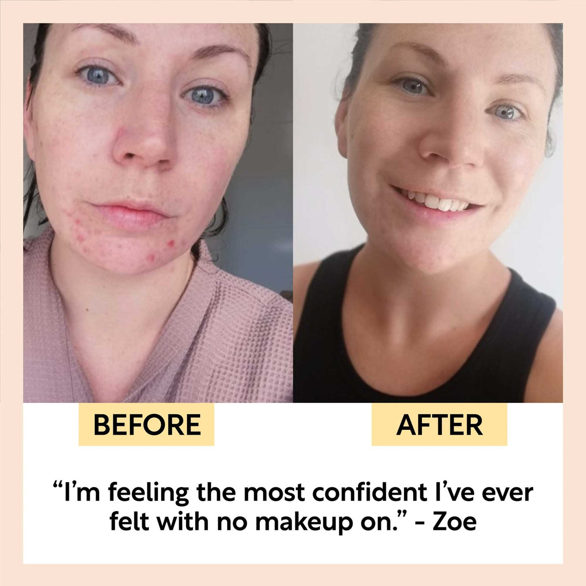 Sunscreen - Face - SPF 25 - Upcycled raspberries - Travel Size